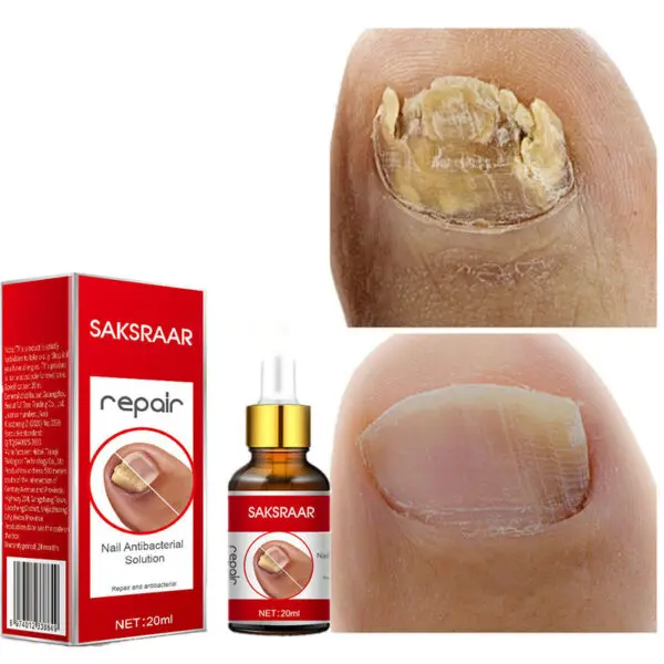 Nail Infections Treatment Serum