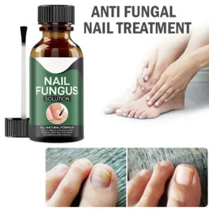 ANTI FUNGAL Toenail Fungus Treatment 6 ANTI FUNGAL Toenail Fungus Treatment