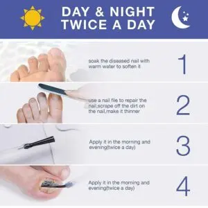 ANTI FUNGAL Toenail Fungus Treatment 8 ANTI FUNGAL Toenail Fungus Treatment