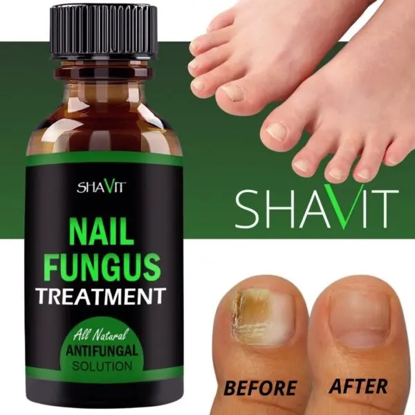 SHAVIT Natural Toenail Fungus Treatment