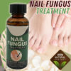 ANTI FUNGAL Toenail Fungus Treatment