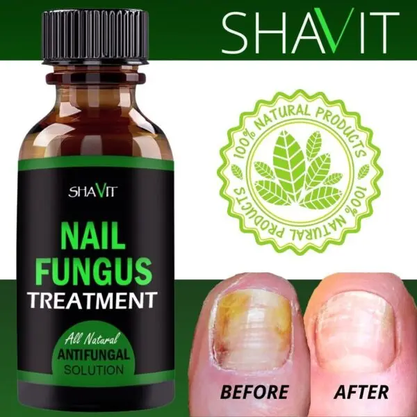 SHAVIT Natural Toenail Fungus Treatment