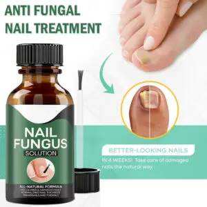 ANTI FUNGAL Toenail Fungus Treatment 7 ANTI FUNGAL Toenail Fungus Treatment